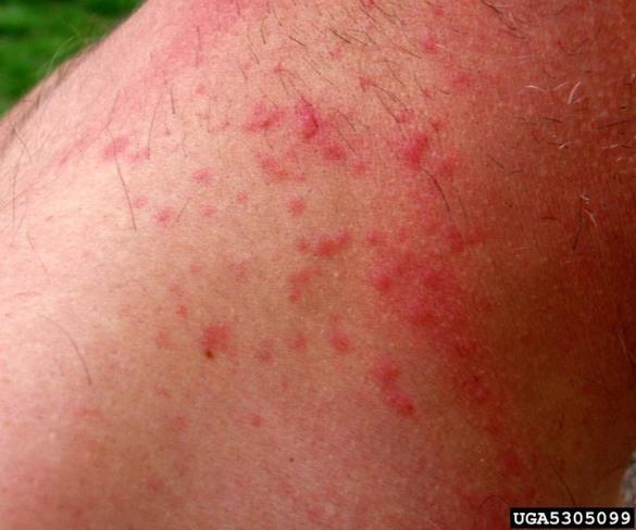 zlatnica ali zlatoritka (<i>Euproctis chrysorrhoea</i>)