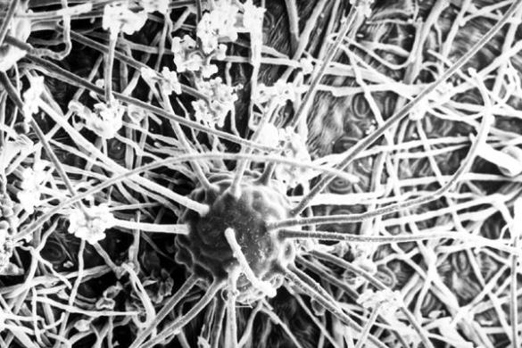 <i>Podosphaera clandestina</i>